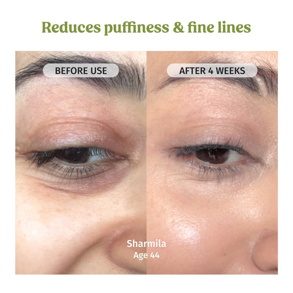 Under Eye Cream (Dark Circles Control)