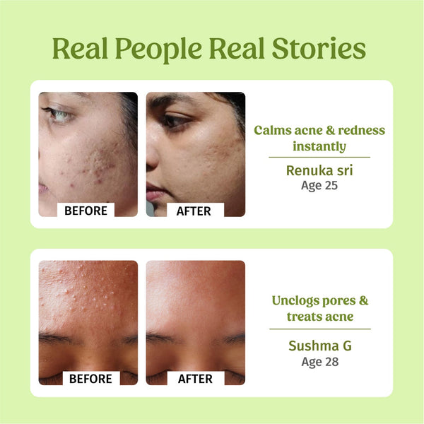 Sensitive Skin Combo