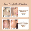 Skin Brightening Combo