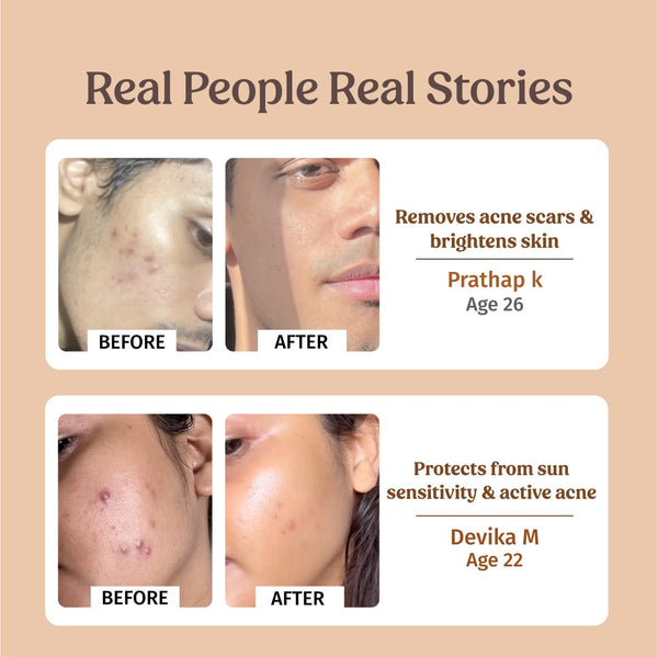 Skin Brightening Combo