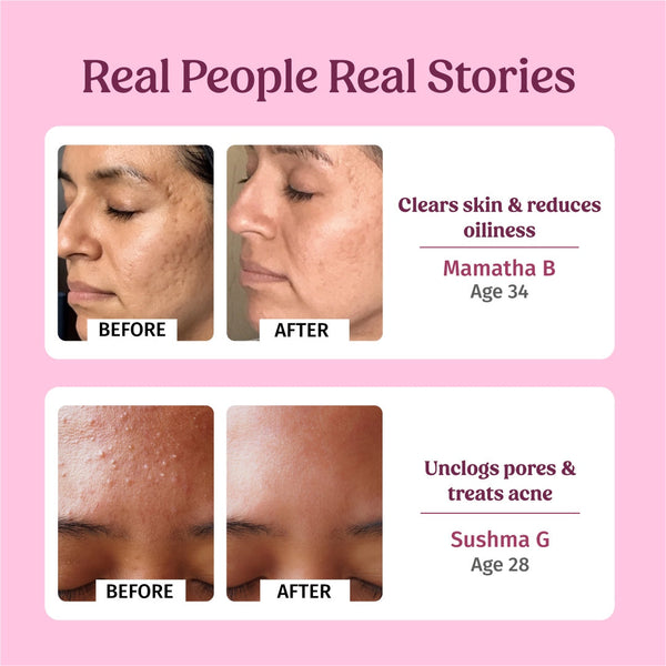 Rose Water Facial Toner