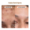 Milk Drops Brightening Serum