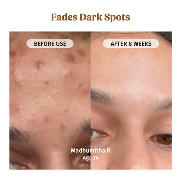 Milk Drops Brightening Serum