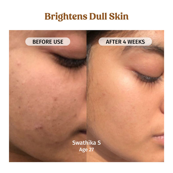 Milk Drops Brightening Serum