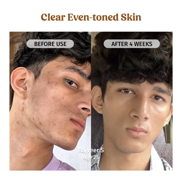 Milk Drops Brightening Serum