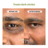 Under Eye Cream (Dark Circles Control)